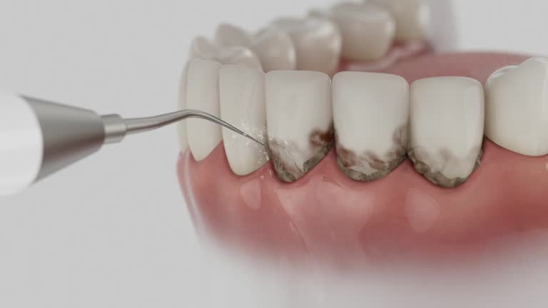 Reliable Dental Implants contractor in Fair Oaks, CA by Smile Center Dentistry